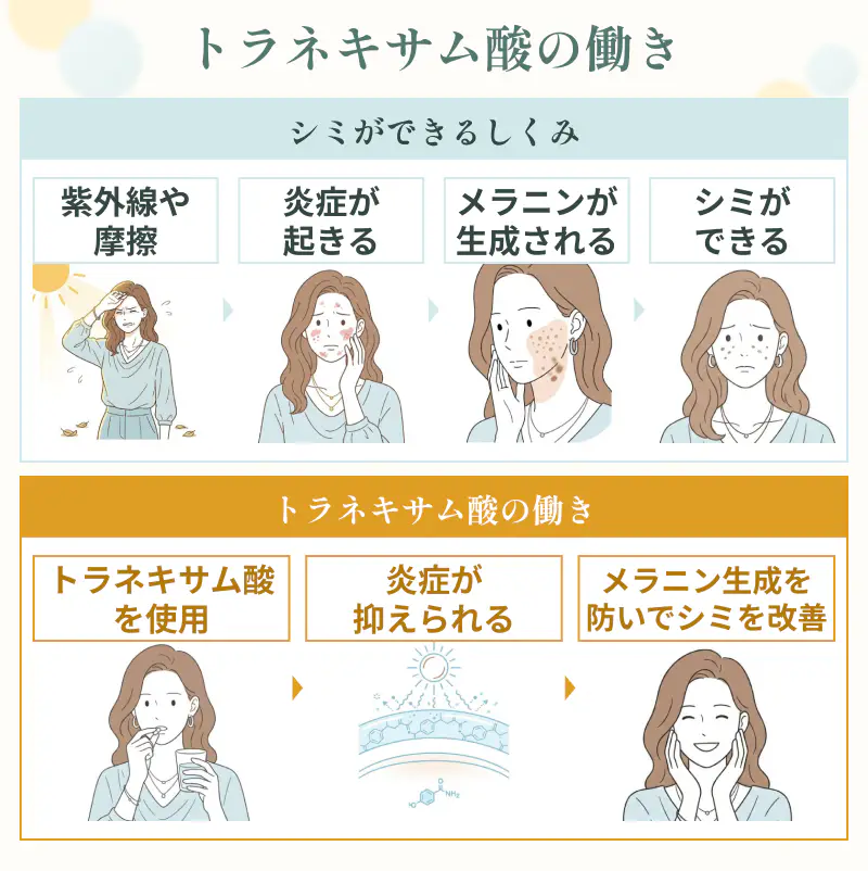 トラネキサム酸の働きを解説した画像