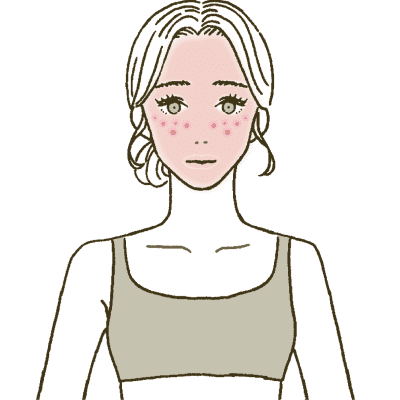 あかみ